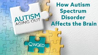 How Autism Spectrum Disorder Affects the Brain | Autism: Aging Out