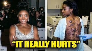 25 Black Celebrities Who Are Fighting The Worst Deadly Diseases (As Of 2026)