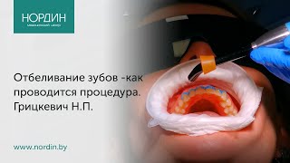 Отбеливание зубов - как проводится процедура, что такое \