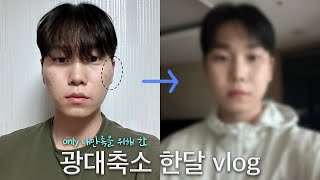 [금동 vlog] 광대 하나로 이렇게 달라진다고 ..? 한달차 꽉꽉 눌러담았습니다🌟