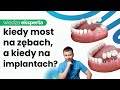 MOSTY NA IMPLANTACH. KIEDY MOST NA ZĘBACH, A KIEDY NA IMPLANTACH? ZALETY MOSTÓW NA IMPLANTACH.