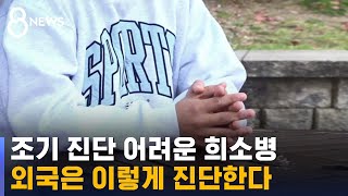 희소병 환자 200만 명 추정…해법은 '국가 진단' / SBS