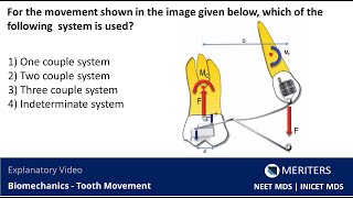 NEET MDS | INICET - Biomechanics - Tooth Movement | Explanatory Video | MERITERS