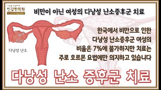 비만이 아닌 경우의 다낭성난소증후군 치료는 소통과 신장기능강화입니다