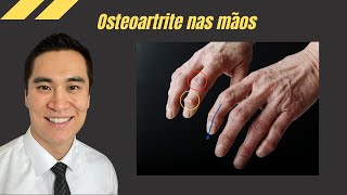 Learn all about Osteoarthritis in hands