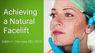 What To Know Before Getting A Facelift