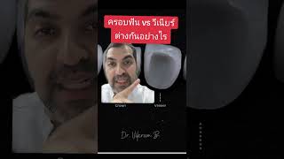 ครอบฟัน vs วีเนียร์ ต่างกันมั้ย ❓❓