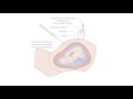 Learn about the Amniocentesis procedure to detect chromosomal abnormalities in a fetus