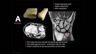 Imaging of wrist joint