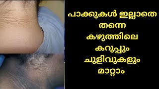 കഴുത്തിലെ കറുപ്പ്  Dark Neck ചുളിവുകൾ Wrinkles പായ്ക്ക് ഇല്ലാതെ തന്നെ മാറ്റാം|Neck Massage Malayalam