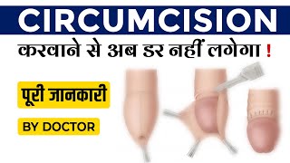 Penis खतना करवाने से पुरुषों को लाभ होता? Stapler circumcision Foreskin Surgery Benefits in Hindi