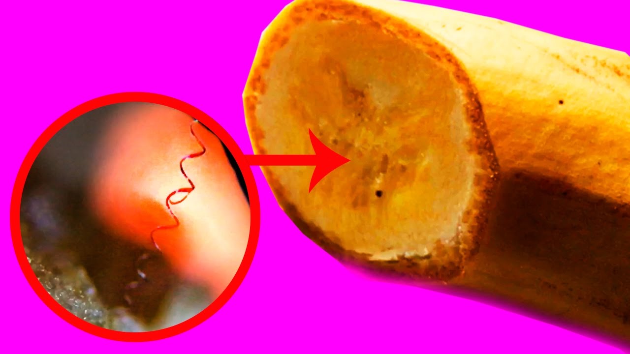 Banana Under Microscope At Lily Holtze Blog