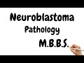 Neuroblastoma Pathology Lecture : Pathogenesis Clinical features Pathology Staging Prognosis ||