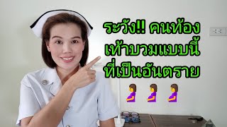 #คนท้องเท้าบวมแบบนี้ที่เป็นอันตราย🤰🤰🤰