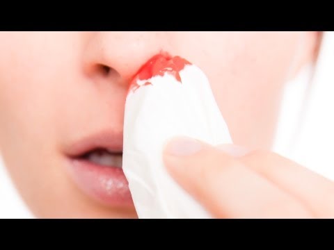 How to Treat a Nosebleed | First Aid Training How to Treat a Nosebleed | First Aid Training