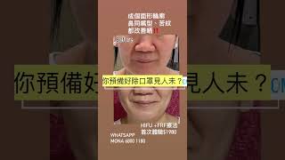 你預備好除口罩見人未？？？