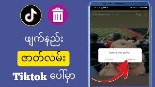 Tiktok တွင် သင့် Story ကို မည်ကဲ့သို့ ဖျက်နည်း (Update အသစ်) |  Tiktok Story ကို ဘယ်လိုဖျက်မလဲ။