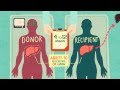 Organ Donation & Liver Transplantation