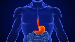 Antacid Treatment for Acid Reflux Stomach Gastroenterology stock footage | stock video | Cinefootage