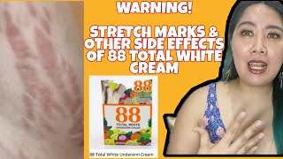 STOP USING 88 TOTAL WHITE UNDERARM WHITENING CREAM! || SIDE EFFECTS (STRETCH MARKS, RASHES ETC)