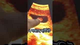 ৭ সপ্তাহে হার্টবিট #shortvideo