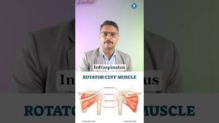 Understanding Rotator Cuff Tear \u0026 it’s treatment!