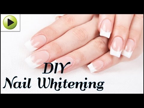 How to Whiten Your Nails Naturally How to Whiten Your Nails Naturally