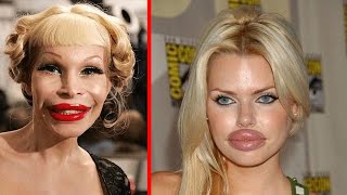 Celebrity Plastic Surgeons Who Should Be Stopped