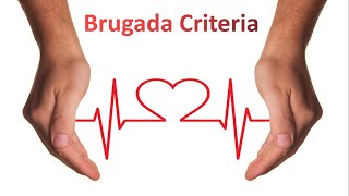 Brugada Criteria for VT vs SVT I ECG Made Super Easy