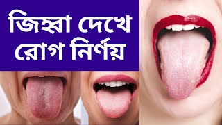 জিহ্বা দেখে রোগ নির্ণয় | জিহবার রং দেখে সারীরিক সমস্যা জানুন | শরীরের বিভিন্ন রোগের লক্ষণ