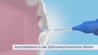 TePe Interdental Gel – effektiver Schutz für Zahnfleisch und Zähne