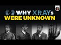 Why X-rays Were UNKNOWN [CC]