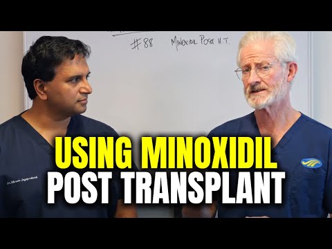 The role of Minoxidil after hair transplantation