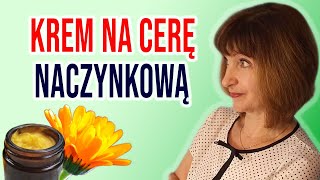 🍀Domowy krem na CERĘ NACZYNKOWĄ z nagietkiem. PRZEPIS