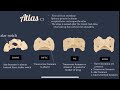 Axial | Comparative Vet Anatomy | Skeletal System ( skull, vertebral column, ribs, sternum, hyoid)