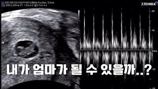 시험관브이로그:: 좋은 소식 전하자마자 이별이라니,,(난임브이로그 계류유산 시험관 8주유산 연속유산 시험관3일배양 신선이식 세번째계류유산 난임병원)