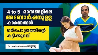 4 to 5 മാസങ്ങളിലെ അബോർഷനുള്ള കാരണങ്ങൾ( Cervical Incompetence)| Reason for Abortion at 4 to 5 Months