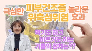 극심한 피부 건조증에 이 캡슐 한알 터뜨려 직접 만들어 보세요. 먹기도 하고 바르기도 하는 기름. 위축성위염엔 먹고 건조증엔 바릅니다