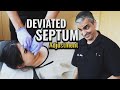 Years of difficulty breathing alleviated! Deviated Septum Adjustment - Dr. Rahim