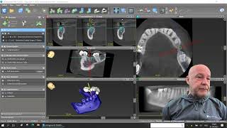 coDiagnostiX® Tips and Tricks 01 | Export Plan