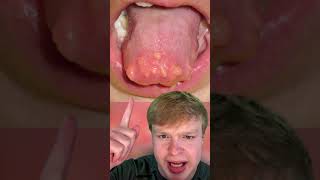 YOU Should NEVER Lick An Envelope And This Is Why! 🤮