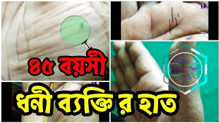 হস্তরেখা পাঠ | ৪৫ বয়সী ধনী ব্যক্তির হাতের শুক্র পর্বতের তিল |  @AstrologerGhoshBengali