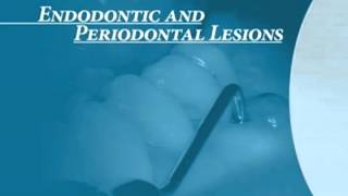 Endodontics Torabinejad 6-0 Endo Perio Introduction