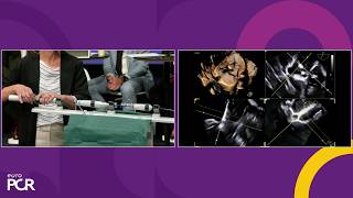 When less is better - Differentiated therapies to safely achieve TR 0-1+ | EuroPCR 2026