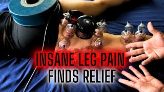 Pulled Quad & Hamstring INSANE ASMR | Deep Tissue, Cupping & PEMF for RDL Recovery