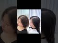 역대급시술전후영상~ 헤어증모 hairextension hairstyle 프레야헤어 증모술