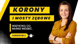 Korony i mosty zębowe. Wszystko, co musisz widzieć.