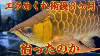 エラめくれ素人手術をして３ヶ月経過、果たして治ったのか