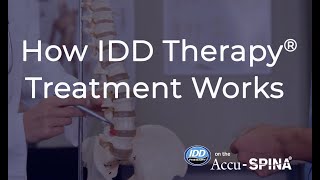 How IDD Therapy Treatment Works