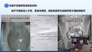 乔新荣深度教学输卵管造影之：不孕症做无痛输卵管造影查的比较准